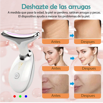 LumiLift™ – Reafirma y Rejuvenece tu Piel con Tecnología IPL